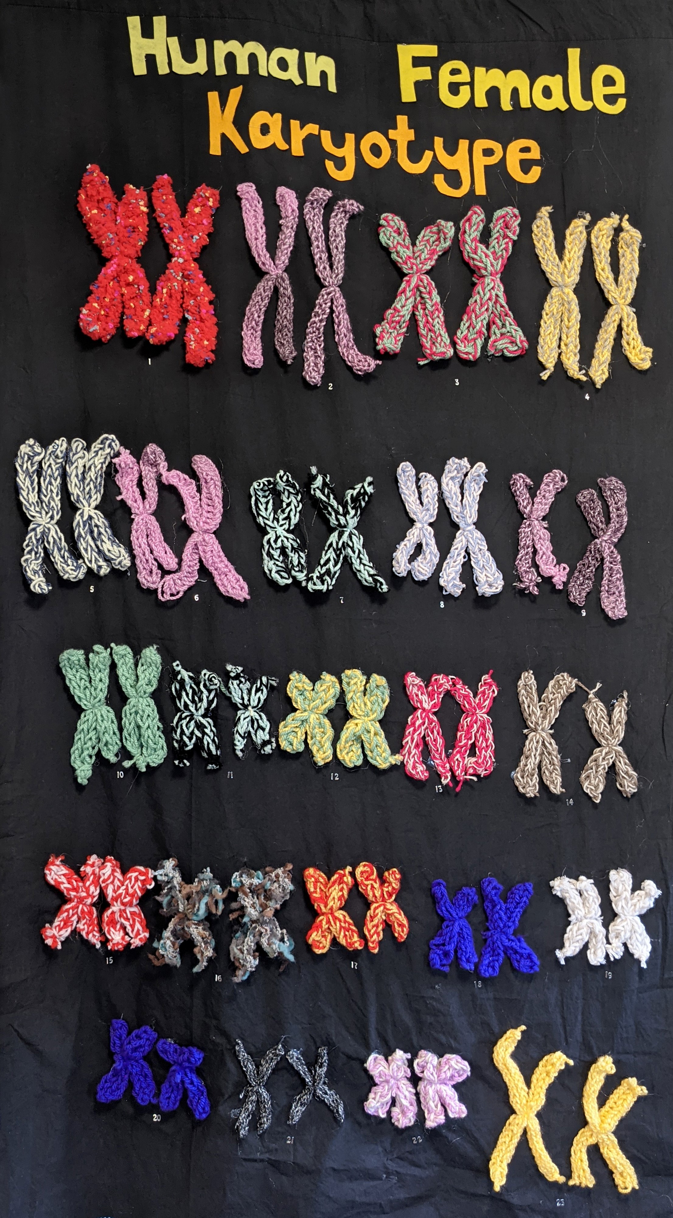 Human Female Karyotype